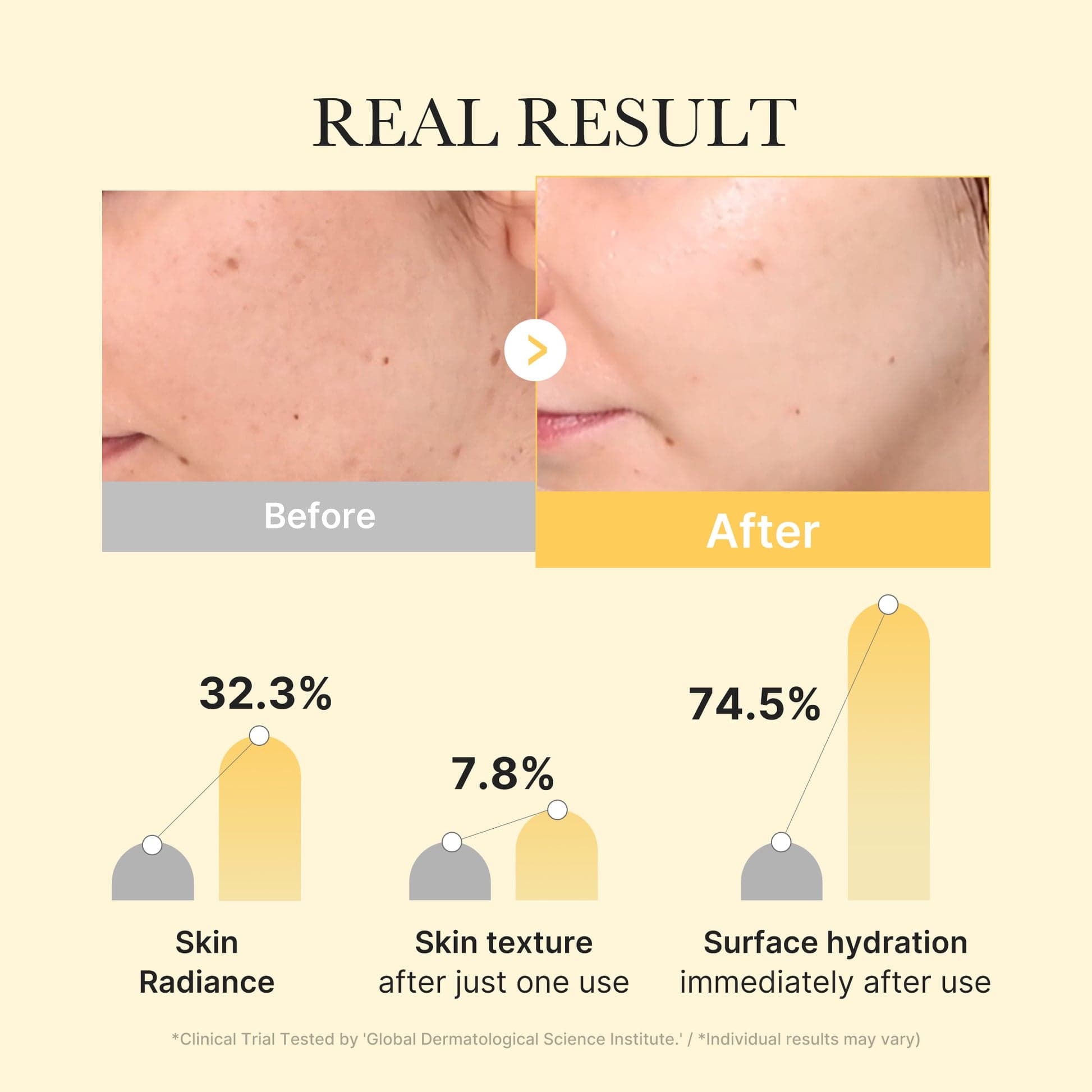 Medicube Jelly Gel Mask with Brightening Kojic Acid Turmeric, 4EA — foto 3
