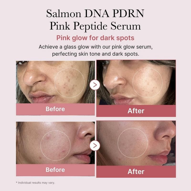 Medicube PDRN Pink Peptide Serum with Rose PDRN — foto 3